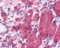 KIAA0152 / MLEC Antibody (Internal)